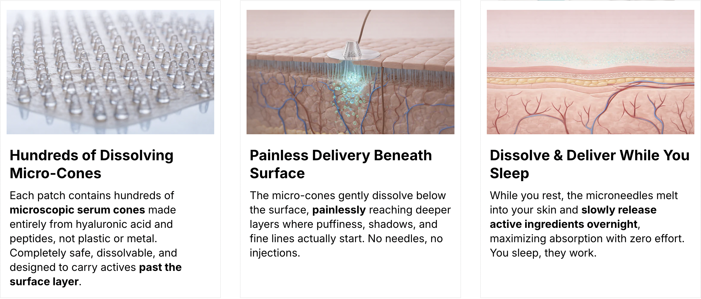 Hundreds of dissolving micro-cones — how the patch works